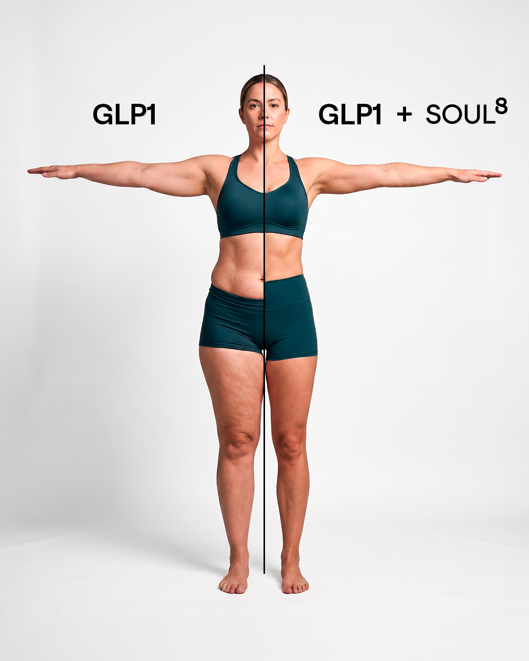 Comparação GLP1 versus GLP1 + Soul8